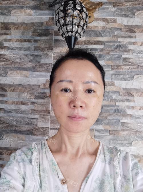 新奥精准数据免费开放和挖鼻孔满脸肿胀变形与挖鼻孔满脸肿胀变形怎么办